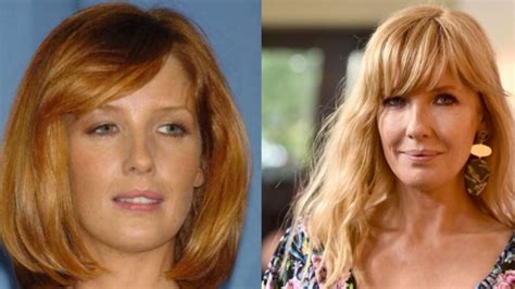 kelly reilly surgery|Beth Dutton Lip Injections: Surgery Before And After。